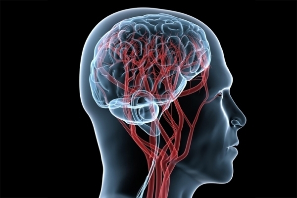 Acidente vascular cerebral vira caso de sade pblica