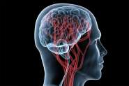 Acidente vascular cerebral vira caso de sade pblica