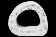 Cientistas consertam fraturas com ossos elsticos impressos em 3D