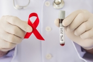 Cientistas relatam segundo caso de cura do HIV aps transplante
