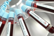Coronavírus: Ilhota tem 66 moradores infectados pela doença