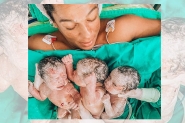 Aps ter um filho na primeira gestao e dois na segunda, mulher d  luz trigmeos em Itaja