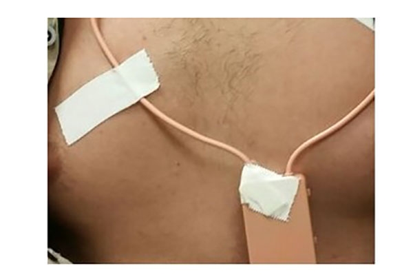 Candidato  preso por usar ponto eletrnico durante Enem no Cear