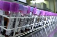 Laboratrio pblico de Palhoa  interditado aps arrombamento