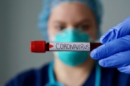 Primeiro caso confirmado de coronavrus no Brasil passa por contraprova nesta quarta
