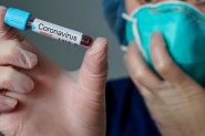 Ministrio da Sade confirma novos casos de coronavrus no Brasil
