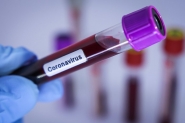 Sobe para cinco o nmero de casos suspeitos de coronavrus em Gaspar