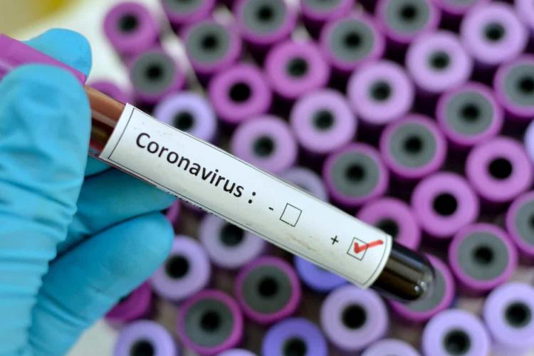 Estado registra 1.091 casos confirmados e 37 bitos por Covid-19
