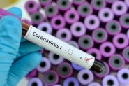 Estado registra 1.091 casos confirmados e 37 bitos por Covid-19