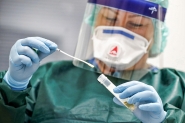 Anvisa aprova testes rpidos de coronavrus em farmcias e drogarias