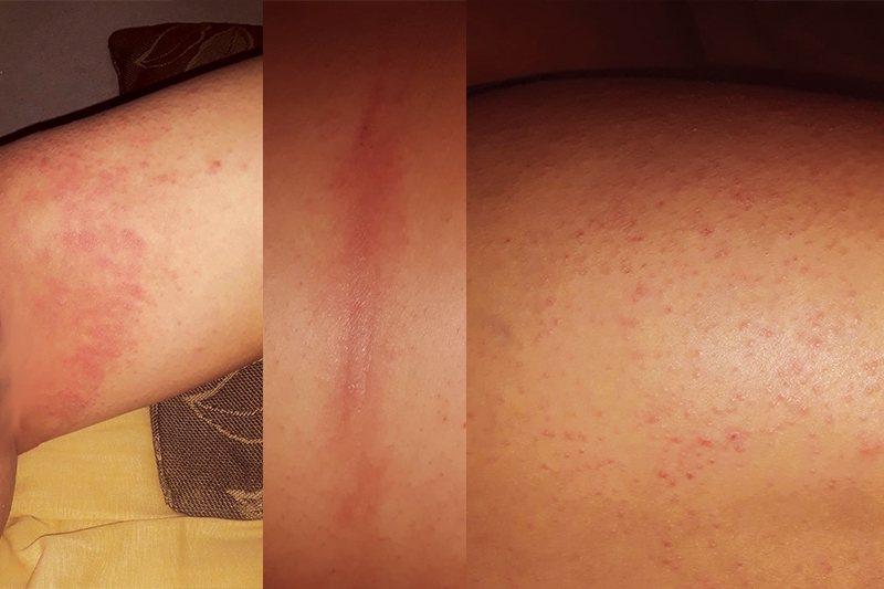 Qualidade da gua preocupa moradores de Ilhota