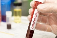 Ilhota registra 12 novos casos de coronavrus e j contabiliza 50 infectados