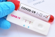 Blumenau passa dos mil casos confirmados de Covid-19