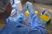 Laboratrio Lacen recebe kits que equivalem a 25 mil testes de coronavrus