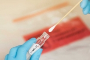 Voc sabe como funcionam os testes para Covid-19?
