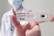Aurora faz testes de Covid-19 em 11 mil funcionrios de SC