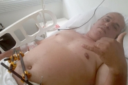 Gasparense vtima de acidente de trnsito pede ajuda para tratamento de sade
