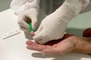 Testes rápidos de Covid-19 começam a ser feitos em toda a população nos postos de Gaspar