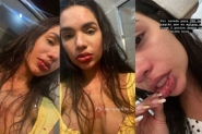 Trancada no banheiro, influencer usa Instagram para pedir ajuda aps agresso em Florianpolis