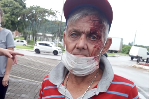 Idoso sofre queda, machuca a cabea e central dos bombeiros no gera ocorrncia