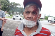 Idoso sofre queda, machuca a cabea e central dos bombeiros no gera ocorrncia