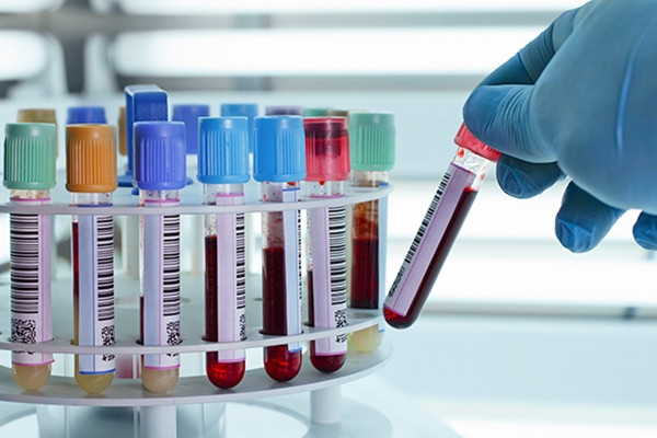 Hepatite misteriosa: novo caso suspeito � notificado em SC