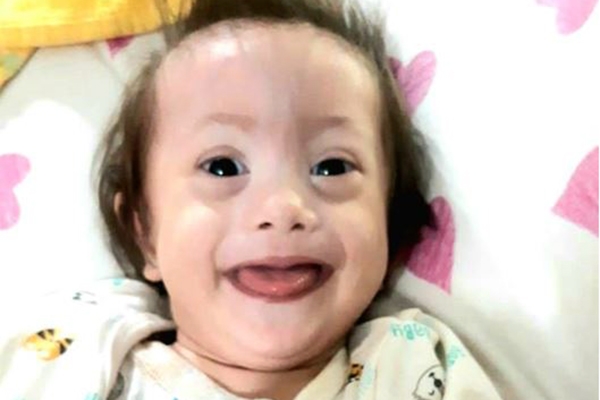 Família de Gaspar arrecada dinheiro para cirurgia de bebê com problema no coração