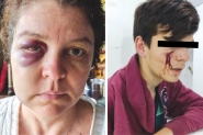 Mulher e adolescente so espancados em Ilhota