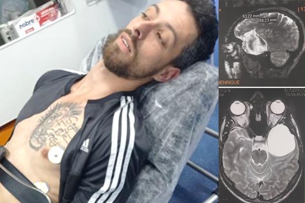 Jovem de Ilhota precisa de ajuda para realizar cirurgia de urgência
