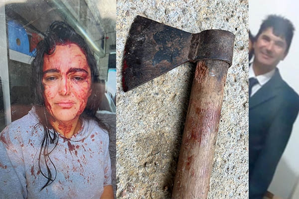 Polícia detalha tentativa de feminicídio em Blumenau: homem usou arma e machadinha para ferir mulher