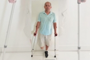 Morador do Coloninha pede ajuda para comprar prótese