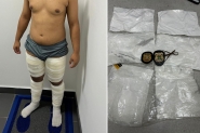 Jovem que tentava ir para Paris com drogas coladas no corpo é preso no Aeroporto de Navegantes